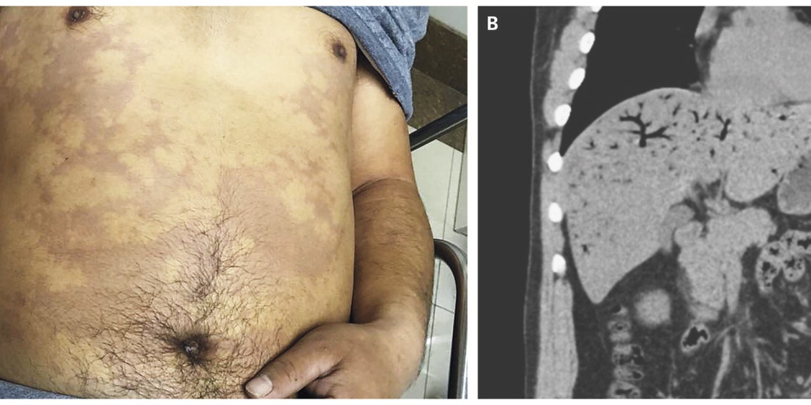 El buceo es seguro, si nosotros lo hacemos de un modo seguro.